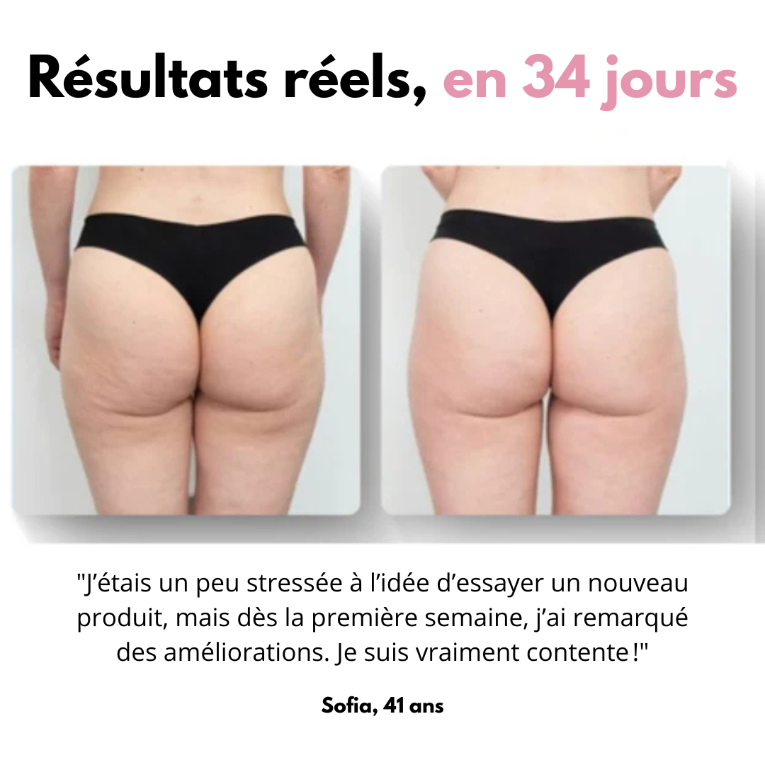 Masseur anti-cellulite Shapea